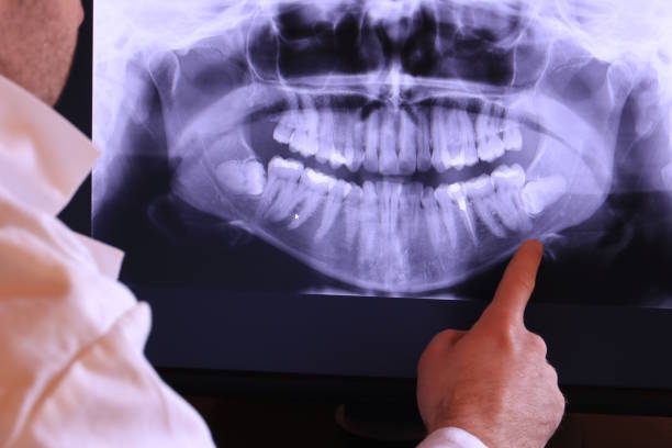 Best Emergency Treatment for Jaw Pain or Injury in East Washington, PA